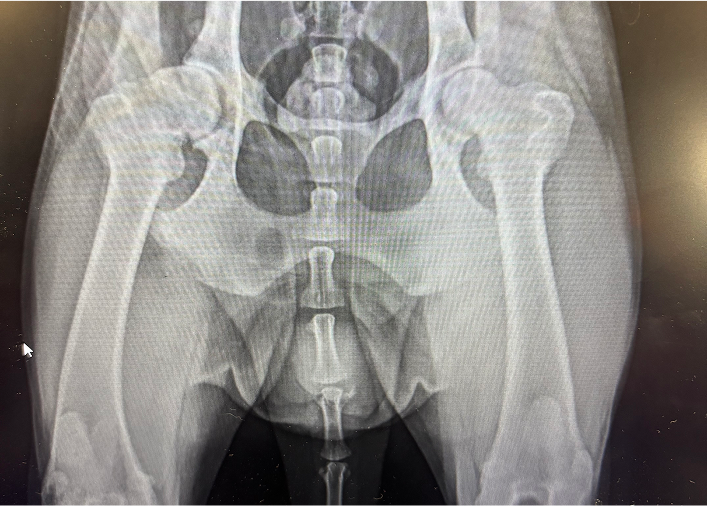 X-ray image showing the hip and pelvis, highlighting bone structure and joint alignment for medical analysis.